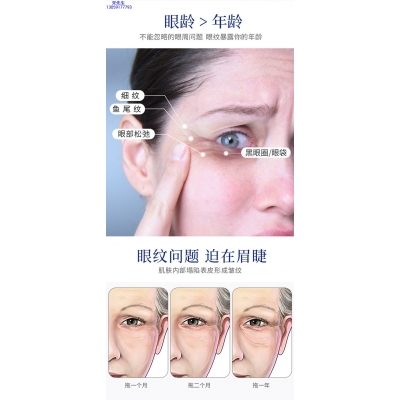 黔东南苗族侗族自治州_美容院玻尿酸微针眼贴